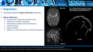 Trombosis Venosa Cerebral
 Diagnóstico.
 Se pueden observar signos indirectos y directos
 Signos indirectos:
 Erosión de las Estructuras del oído medio
 Cambios en la región mastoidea
 Hidrocefalia y Comprensión del Ventrículo
 Infartos Venosos
 Edema Cerebral
 Realce de la Hoz del Cerebro y Tentorio Cerebeloso
G. Guenther, y A. Arauz. Trombosis venosa cerebral: aspectos actuales del diagnóstico y tratamiento; Neurología Vol.26. Núm. 08. 2011.
Puig J, Pedraza S, Blasco G, Serena J. Actualización en el diagnóstico neurorradiológico de la trombosis venosa cerebral. Radiología. 2009;51:351—561.
 