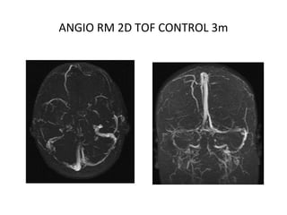 ANGIO RM 2D TOF CONTROL 3m
 