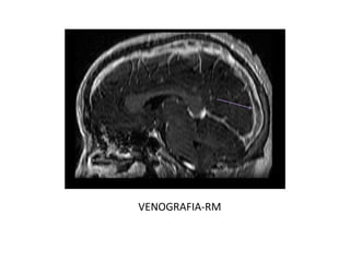 VENOGRAFIA-RM
 