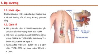 1. Đại cương
1.1. Khái niệm
Thoát vị đĩa đệm: nhân nhầy đĩa đệm thoát ra khỏi
vị trí bình thường của nó trong khoang gian đốt
sống.
1.2. Dịch tễ
 Mỹ: tỷ lệ mắc bệnh là 1/4000 người/năm, gần
20% dân số ở tuổi trưởng thành mắc TVĐĐ
 Việt Nam: lứa tuổi lao động có tới 80% bn có hội
chứng TLH là do TVĐĐ CSTL, hội chứng TLH
chiếm 60,32% bệnh TK ngoại vi.
 Tại Khoa Nội Thần kinh - BVQY 103: tỷ lệ bệnh
nhân TVĐĐ CSTL tại khoa chiếm 26,94% -
41,54%.
 