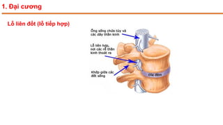 1. Đại cương
Lỗ liên đốt (lỗ tiếp hợp)
 
