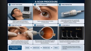 Comprehensive Overview of A-Scan Biometry in Ophthalmology | PDF
