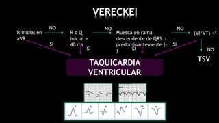 Taquicardia Ventricular.pptx