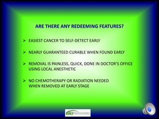 ARE THERE ANY REDEEMING FEATURES?
Ø EASIEST CANCER TO SELF-DETECT EARLY
Ø NEARLY GUARANTEED CURABLE WHEN FOUND EARLY
Ø REMOVAL IS PAINLESS, QUICK, DONE IN DOCTOR’S OFFICE
USING LOCAL ANESTHETIC
Ø NO CHEMOTHERAPY OR RADIATION NEEDED
WHEN REMOVED AT EARLY STAGE
 