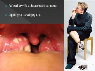  Bolesti krvnih sudova (pušačka noga)
 Upala grla i srednjeg uha
 