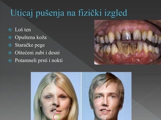  Loš ten
 Opuštena koža
 Staračke pege
 Oštećeni zubi i desni
 Potamneli prsti i nokti
 