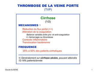 THROMBOSE DE LA VEINE PORTE
(TVP)
Cirrhose
(1/2)
MECANISMES 1)
Réduction du flux portal (++) 
Altération de la coagulation...