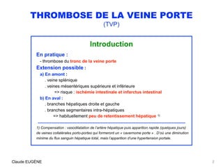 THROMBOSE DE LA VEINE PORTE
(TVP)
Introduction
En pratique :
- thrombose du tronc de la veine porte
Extension possible :
a...