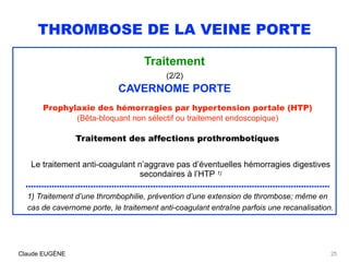 THROMBOSE DE LA VEINE PORTE
Traitement
(2/2)
CAVERNOME PORTE
Prophylaxie des hémorragies par hypertension portale (HTP)
(B...
