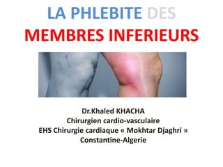 LA PHLEBITE DES
MEMBRES INFERIEURS
Dr.Khaled KHACHA
Chirurgien cardio-vasculaire
EHS Chirurgie cardiaque « Mokhtar Djaghri »
Constantine-Algerie
 