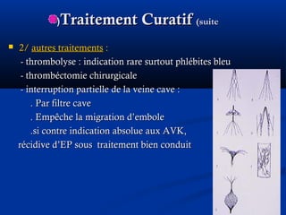 Traitement CuratifTraitement Curatif (suite(suite((
 2/2/ autres traitementsautres traitements ::
- thrombolyse : indication rare surtout phlébites bleu- thrombolyse : indication rare surtout phlébites bleu
- thrombéctomie chirurgicale- thrombéctomie chirurgicale
- interruption partielle de la veine cave :- interruption partielle de la veine cave :
. Par filtre cave. Par filtre cave
. Empêche la migration d’embole. Empêche la migration d’embole
.si contre indication absolue aux AVK,.si contre indication absolue aux AVK,
récidive d’EP sous traitement bien conduitrécidive d’EP sous traitement bien conduit
 