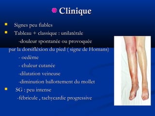 CliniqueClinique
 Signes peu fiablesSignes peu fiables
 Tableau + classique : unilatéraleTableau + classique : unilatérale
-douleur spontanée ou provoquée-douleur spontanée ou provoquée
par la dorsifléxion du pied ( signe de Homans)par la dorsifléxion du pied ( signe de Homans)
- oedème- oedème
- chaleur cutanée- chaleur cutanée
-dilatation veineuse-dilatation veineuse
-diminution ballottement du mollet-diminution ballottement du mollet
 SG : peu intenseSG : peu intense
-fébricule , tachycardie progressive-fébricule , tachycardie progressive
 
