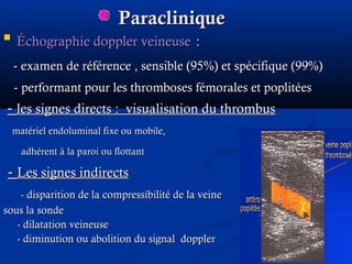 ParacliniqueParaclinique

Échographie doppler veineuseÉchographie doppler veineuse ::
-- examen de référence , sensible (95examen de référence , sensible (95%) et spécifique (99%)%) et spécifique (99%)
-- performant pour les thromboses fémorales et poplitéesperformant pour les thromboses fémorales et poplitées
-- les signes directs : visualisation du thrombusles signes directs : visualisation du thrombus
matériel endoluminal fixe ou mobile,matériel endoluminal fixe ou mobile,
adhérent à la paroi ou flottantadhérent à la paroi ou flottant
-- Les signes indirectsLes signes indirects
- disparition de la compressibilité de la veine- disparition de la compressibilité de la veine
sous la sondesous la sonde
- dilatation veineuse- dilatation veineuse
- diminution ou abolition du signal doppler- diminution ou abolition du signal doppler
 