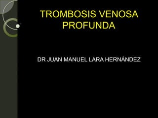 TROMBOSIS VENOSA
PROFUNDA
DR JUAN MANUEL LARA HERNÁNDEZ
 