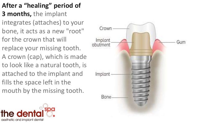 THE DENTAL SPA - Life changing stuff!