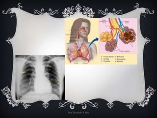 Prof. Fernando A Silva 
 