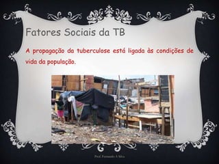 Fatores Sociais da TB 
A propagação da tuberculose está ligada às condições de 
vida da população. 
Prof. Fernando A Silva 
 