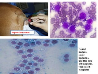 Round
nucleus,
single
nucleolus,
and thin rim
of basophilic,
vacuolated
cytoplasm
Impression smear
 