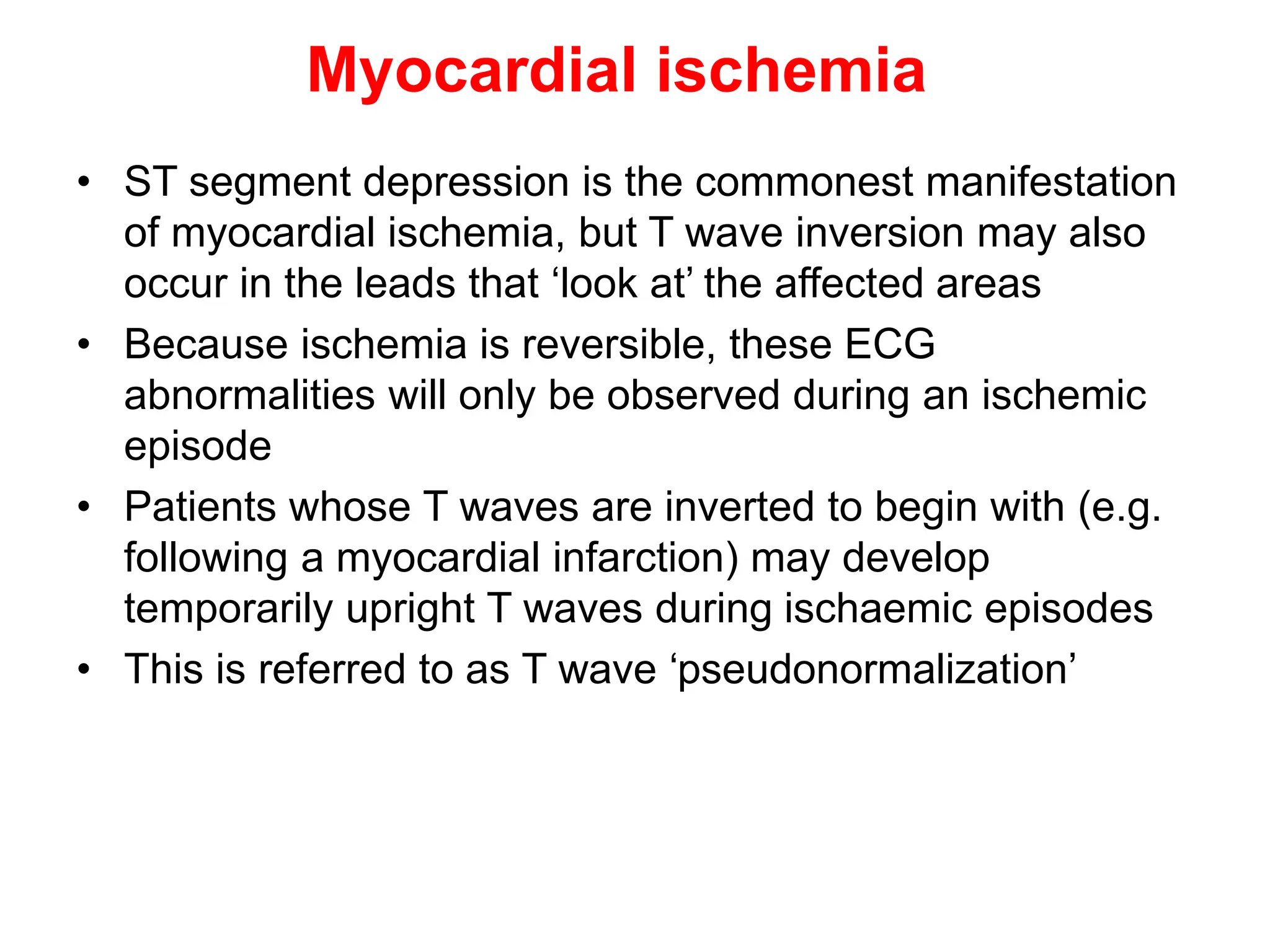 T WAVE IN ECG AND ITS ABNORMALITIES IN ECG | PPTX