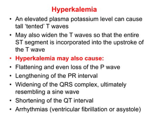T WAVE IN ECG AND ITS ABNORMALITIES IN ECG | PPTX