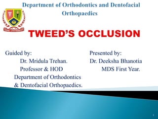 Guided by: Presented by:
Dr. Mridula Trehan. Dr. Deeksha Bhanotia
Professor & HOD MDS First Year.
Department of Orthodontics
& Dentofacial Orthopaedics.
1
 