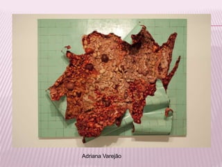 Adriana Varejão 
