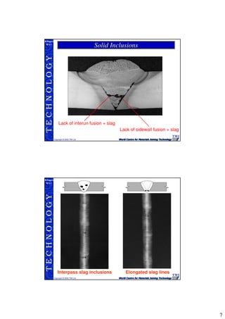 7
TECHNOLOGY
Copyright © 2005 TWI Ltd
WI 3.1
M.Rogers
Solid InclusionsSolid Inclusions
Lack of interun fusion + slag
Lack of sidewall fusion + slag
TECHNOLOGY
Copyright © 2005 TWI Ltd
WI 3.1
M.Rogers
Elongated slag linesInterpass slag inclusions
 