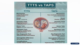 Ttspps Guidelines.pdf Twin-Twin-Transfusion-Syndrome-TTTS.pptx