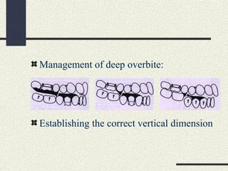 Management of deep overbite:
Establishing the correct vertical dimension
 