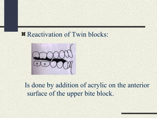 Reactivation of Twin blocks:
Is done by addition of acrylic on the anterior
surface of the upper bite block.
 