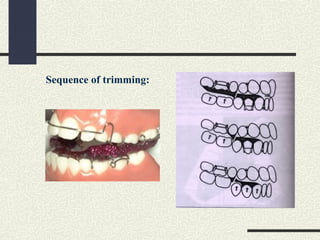 Sequence of trimming:
 