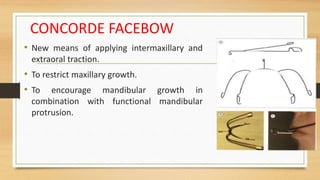 CONCORDE FACEBOW
• New means of applying intermaxillary and
extraoral traction.
• To restrict maxillary growth.
• To encourage mandibular growth in
combination with functional mandibular
protrusion.
 