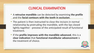 CLINICAL EXAMINATION
• A retrusive mandible can be detected by examining the profile
and the facial contours with the teeth in occlusion.
• The patient is then instructed to close the incisors in normal
relationship by protruding the mandible, with the lips closed
lightly together - preview of the anticipated result of functional
treatment.
• If the profile improves with the mandible advanced, this is a
clear indication that functional mandibular advancement is
the treatment of choice.
 