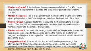 • Nasion horizontal: A line is drawn through nasion parallelto the Frankfort plane.
This defines the upper limit of the face and the anterior point of union with the
cranium.
• Menton horizontal: This is a tangent through menton on the lower border of the
symphysis parallel to the Frankfort plane. It defines the lower limit of the face.
• Nasion vertical: A perpendicular line is drawn to the Frankfort plane through
nasion. This line defines the anteroposterior relationship of the maxilla and the
mandible relative to the anterior cranial base.
• Basion vertical: A perpendicular through basion defines the posterior limit of the
face. Basion is an important anatomical point in the midline on the foramen
magnum, marking the anterior point of union between the cervical column and the
base of the skull.
• Pterygoid vertical: A perpendicular line to the Frankfort plane through the
pterygoid point. This midfacial perpendicular line was selected by Ricketts
because it is in a stable area of growth, being close to the point of emergence of
the trigeminal nerve from the base of the skull.
 