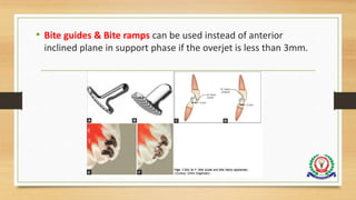 • Bite guides & Bite ramps can be used instead of anterior
inclined plane in support phase if the overjet is less than 3mm.
 