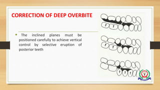 CORRECTION OF DEEP OVERBITE
 The inclined planes must be
positioned carefully to achieve vertical
control by selective eruption of
posterior teeth
75
 