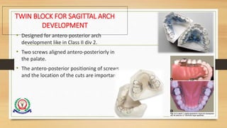 TWIN BLOCK FOR SAGITTAL ARCH
DEVELOPMENT
• Designed for antero-posterior arch
development like in Class II div 2.
• Two screws aligned antero-posteriorly in
the palate.
• The antero-posterior positioning of screws
and the location of the cuts are important.
77
 