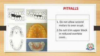 PITFALLS
1. Do not allow second
molars to over erupt.
2.Do not trim upper block
in reduced overbite
cases .
94
 