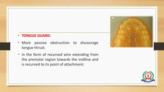 • TONGUE GUARD:
• More passive obstruction to discourage
tongue thrust.
• In the form of recurved wire extending from
the premolar region towards the midline and
is recurved to its point of attachment.
97
 