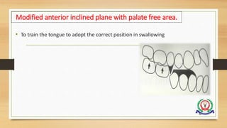 • To train the tongue to adopt the correct position in swallowing
98
Modified anterior inclined plane with palate free area.
 