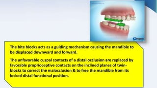 The bite blocks acts as a guiding mechanism causing the mandible to
be displaced downward and forward.
The unfavorable cuspal contacts of a distal occlusion are replaced by
favorable proprioceptive contacts on the inclined planes of twin-
blocks to correct the malocclusion & to free the mandible from its
locked distal functional position.
 