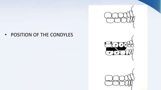 • POSITION OF THE CONDYLES
 