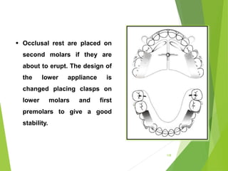 128
 Occlusal rest are placed on
second molars if they are
about to erupt. The design of
the lower appliance is
changed placing clasps on
lower molars and first
premolars to give a good
stability.
 