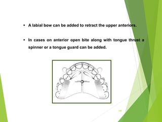 129
 A labial bow can be added to retract the upper anteriors.
 In cases on anterior open bite along with tongue thrust a
spinner or a tongue guard can be added.
 