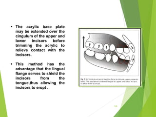130
 The acrylic base plate
may be extended over the
cingulum of the upper and
lower incisors before
trimming the acrylic to
relieve contact with the
incisors.
 This method has the
advantage that the lingual
flange serves to shield the
incisors from the
tongue,thus allowing the
incisors to erupt .
 