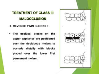 132
TREATMENT OF CLASS III
MALOCCLUSION
 REVERSE TWIN BLOCKS :
 The occlusal blocks on the
upper appliance are positioned
over the deciduous molars to
occlude distally with blocks
placed over the lower first
permanent molars.
 