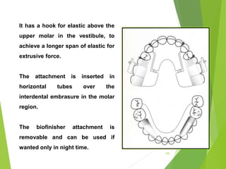 155
It has a hook for elastic above the
upper molar in the vestibule, to
achieve a longer span of elastic for
extrusive force.
The attachment is inserted in
horizontal tubes over the
interdental embrasure in the molar
region.
The biofinisher attachment is
removable and can be used if
wanted only in night time.
 