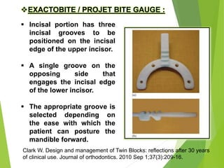 EXACTOBITE / PROJET BITE GAUGE :
 Incisal portion has three
incisal grooves to be
positioned on the incisal
edge of the upper incisor.
 A single groove on the
opposing side that
engages the incisal edge
of the lower incisor.
 The appropriate groove is
selected depending on
the ease with which the
patient can posture the
mandible forward.
41
Clark W. Design and management of Twin Blocks: reflections after 30 years
of clinical use. Journal of orthodontics. 2010 Sep 1;37(3):209-16.
 