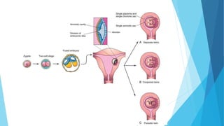 Twining Method Radiography Twining | PPTX