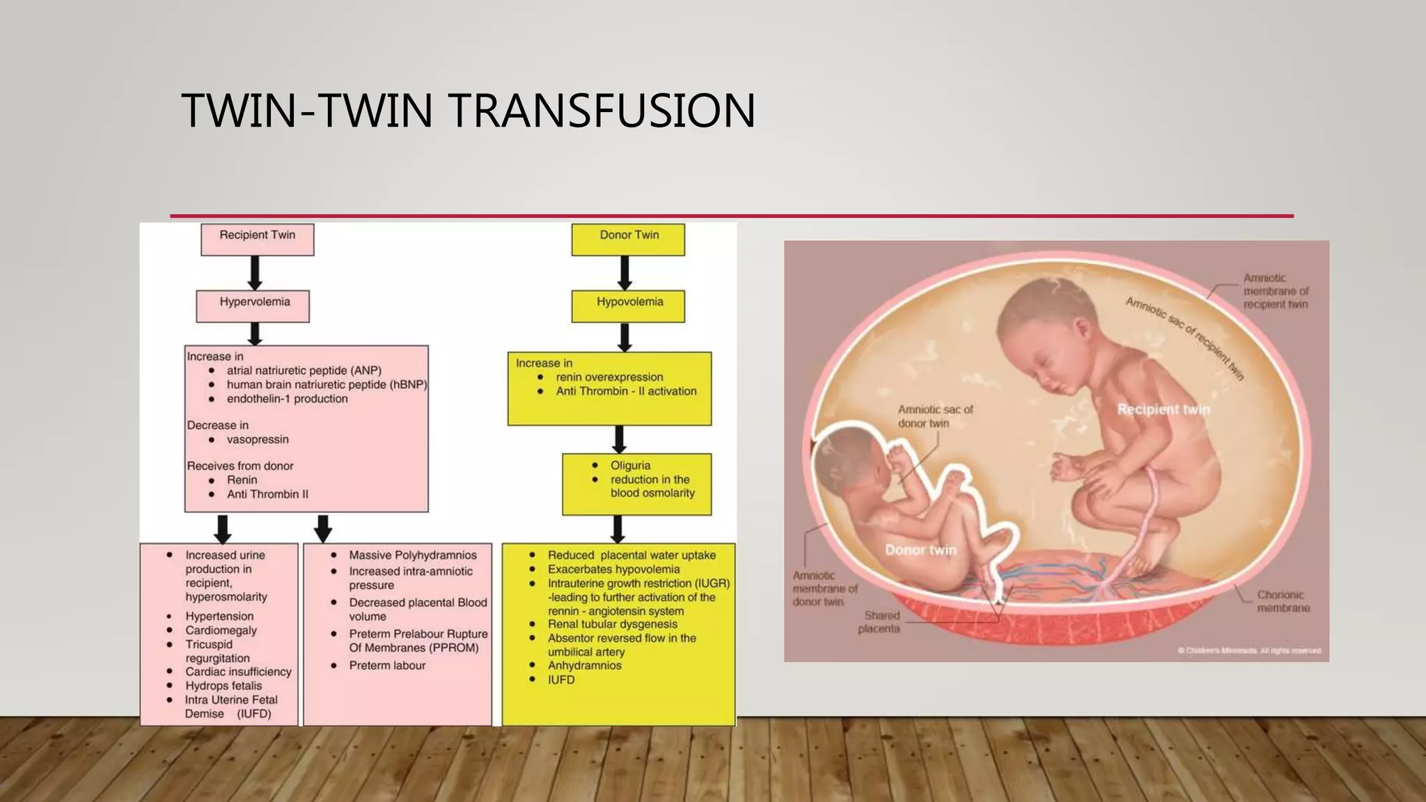 TWIN PREGNANCY | PPTX